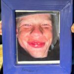 braden
